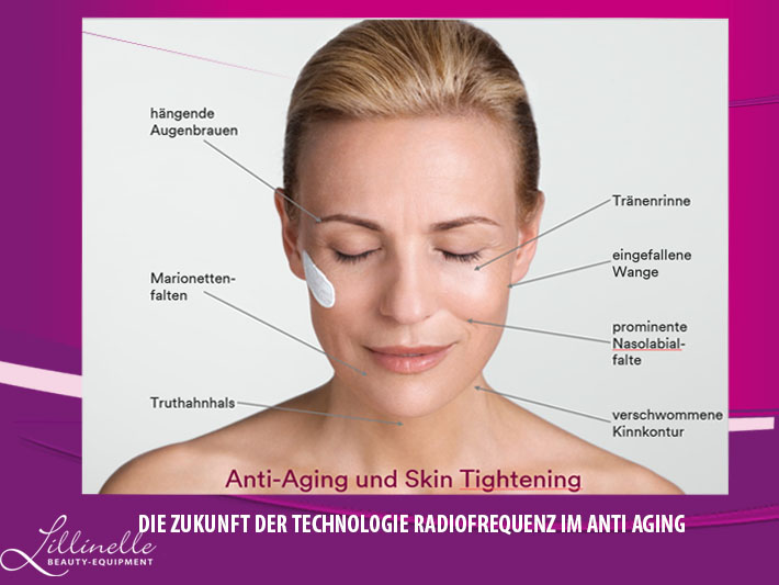 Radiofrequenz-Technologie-die -Zukunft-in der apparativen -Anti-Aging-Kosmetik