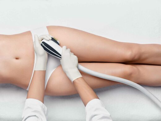 Dauerhafte Haarentfernung in Berlin Steglitz vom Profi