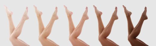 Dauerhafte Haarentfernung mit Hochleistungs Dioden Laser Technologie in Berlin Steglitz